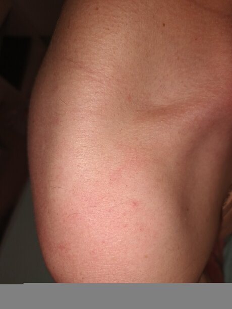 Alexbitchcraft4free estrella hd imágenes