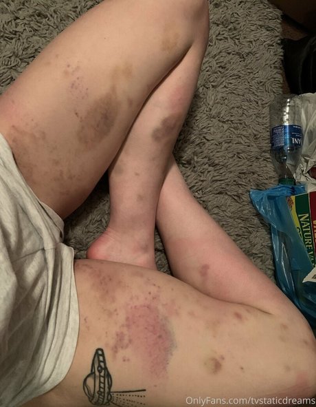 tvstaticdreams estrella superior recopilación