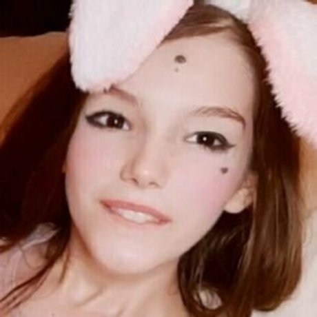 AbnormalXO star top pictures
