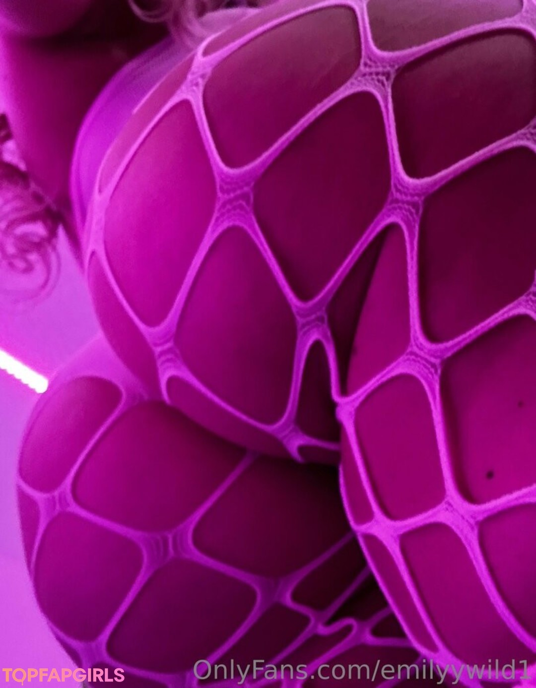 braces onlyfans nice galleries