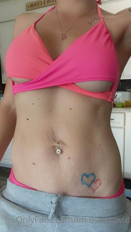 im over covid estrella superior recopilación