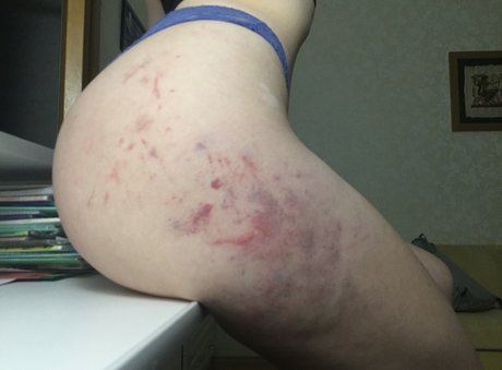 ell8ta estrella hd fotos