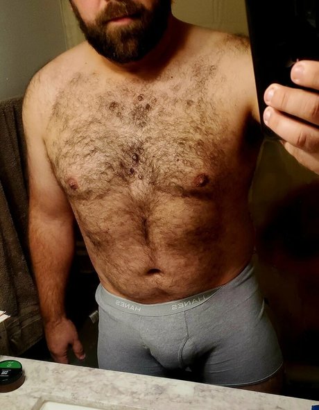braces onlyfans hot naked pic