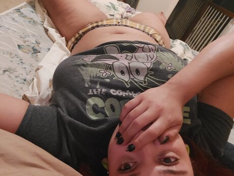 Scartissue erotic model photo