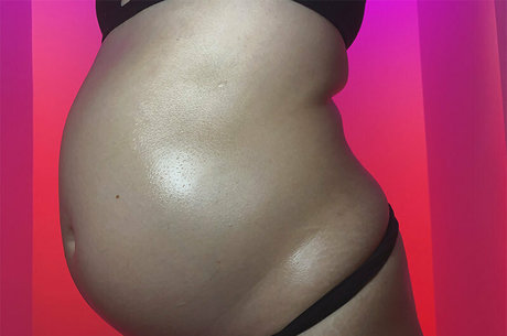 poppykoch meilleur modèle galeries