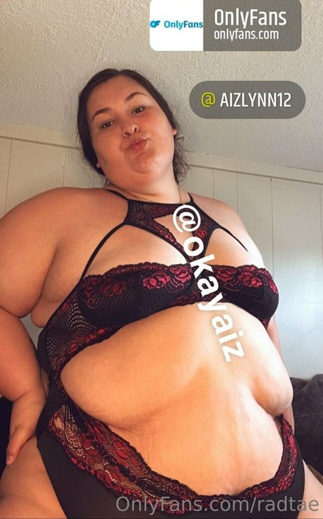 radtae model free galleries