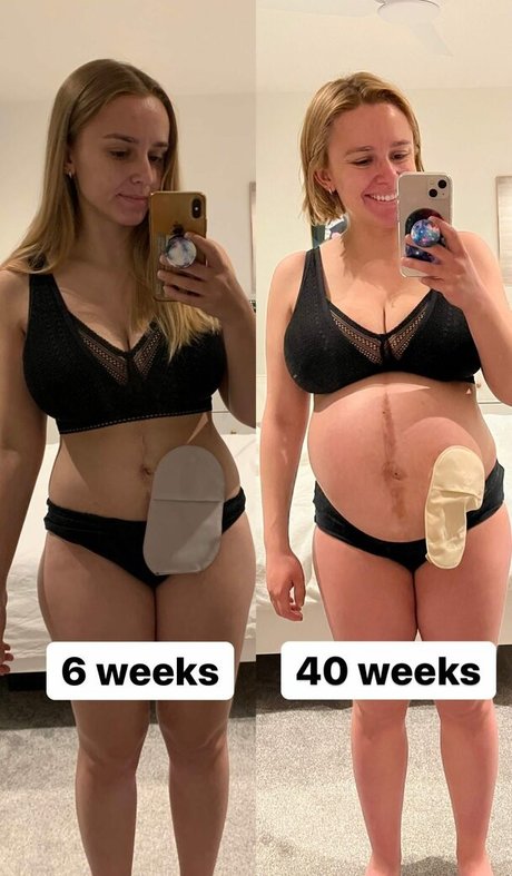 Hannah Witton jolie étoile photo