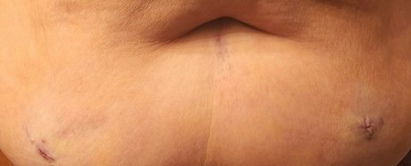 blemishedbeauty actriz exclusiva archivo