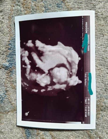 goodluckanne art star du porno img