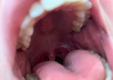 aliceeats actriz de alta definición galería