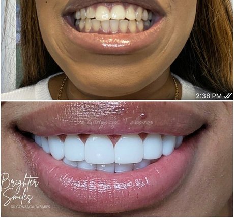 kookooforcocopuffs perfect star pictures