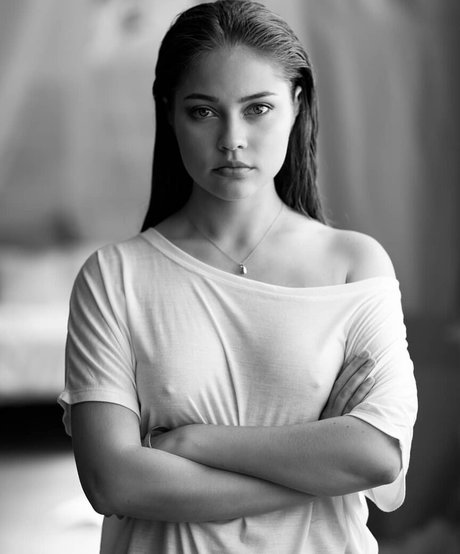 My Xray Work beautiful star pic