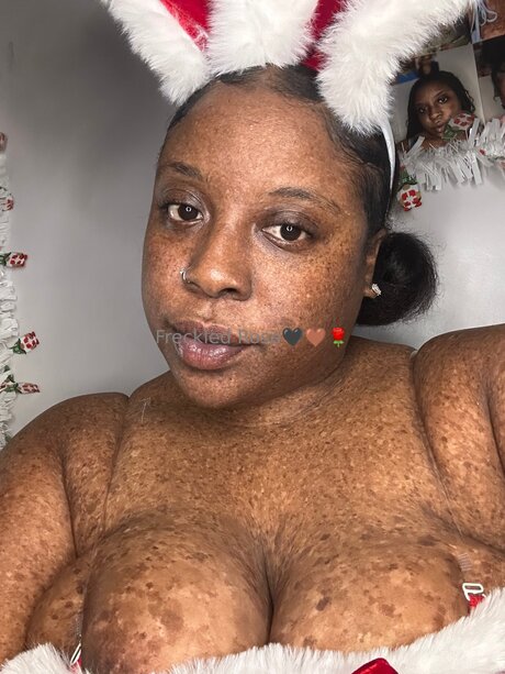 Freckledfantasy5 top model photos