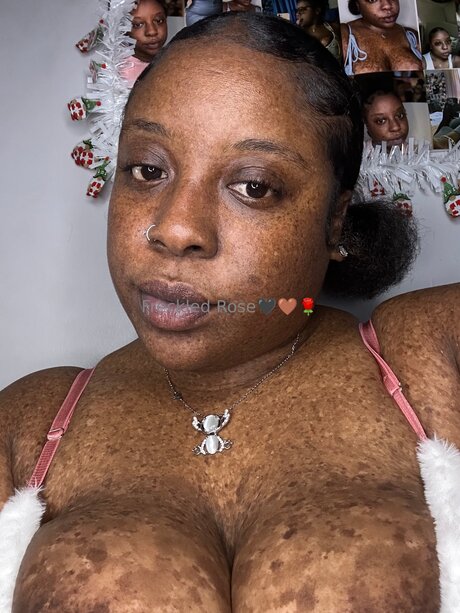 Freckledfantasy5 model nudes image