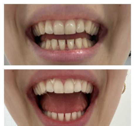 zoenafree best pornstar pictures