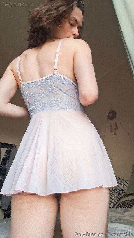 Warmskin star top picture