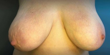 acidalexonly erotic pornstar image