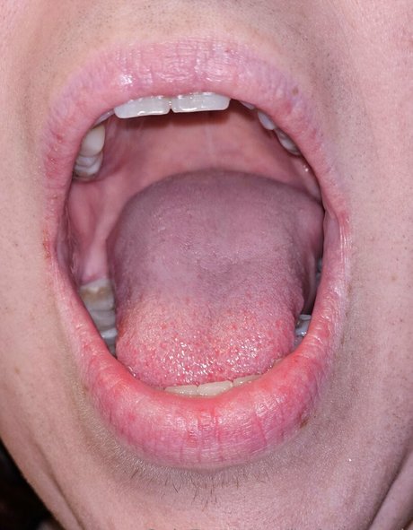 jackdaspeck perfect star photo