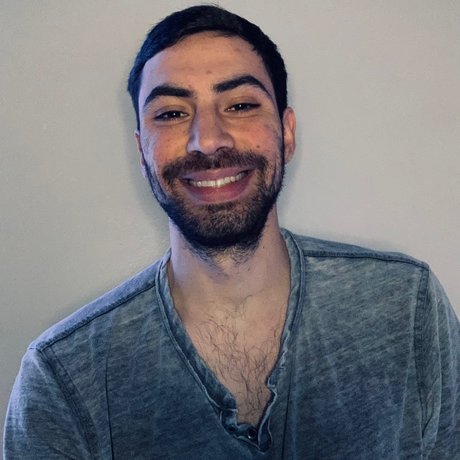 Jgleeems star nudes img