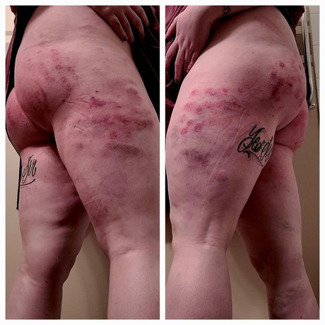 TheTorturedPet model sexy galleries