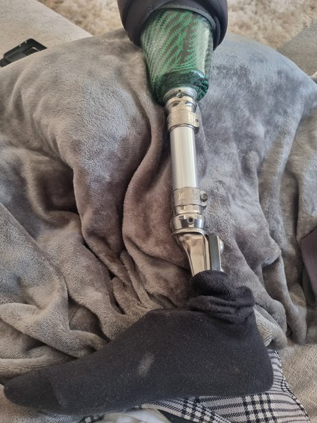 Stumpy star naked archive