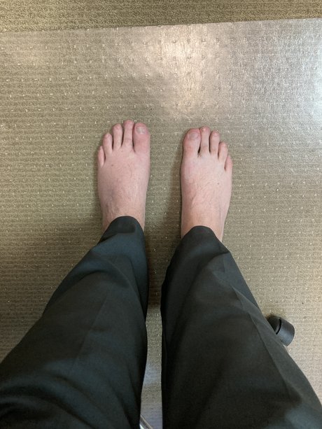 Baldguy star exclusive image