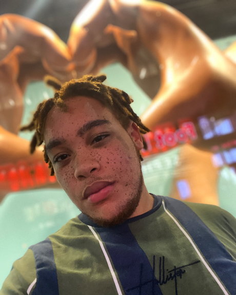 Freckles star sexy photos