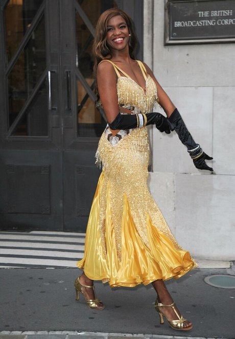 Oti Mabuse star hot image