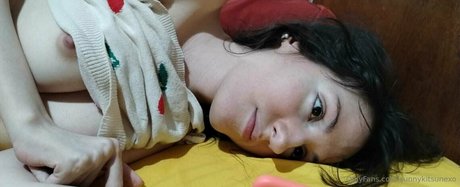 sunnykitsunexo star top images