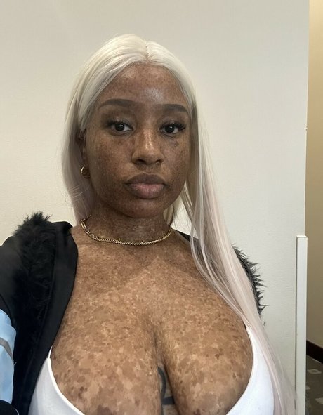 freckledn nudes star pic