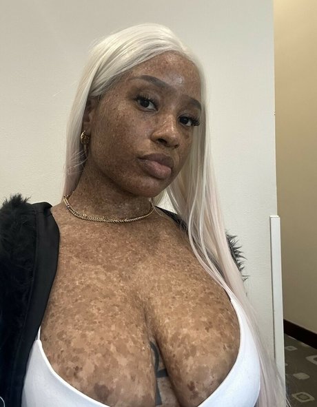 freckledn nude actress archive