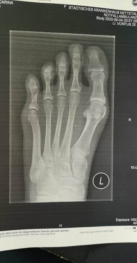 birki heaven pornographic model galleries