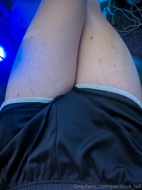 Perilous Hill star nice archive