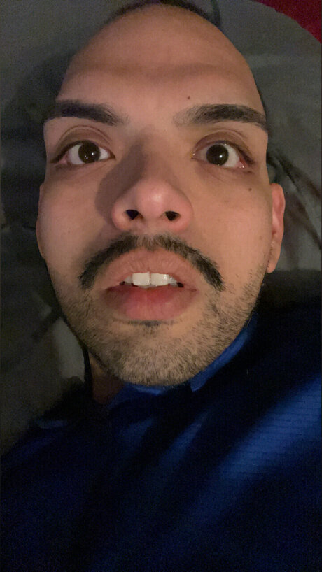 LG730 perfect star image