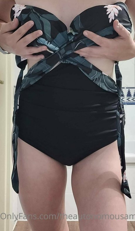 theautonomousamputee2 hd star photos