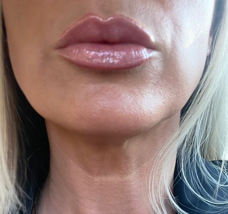 Nipsstrips star best pic