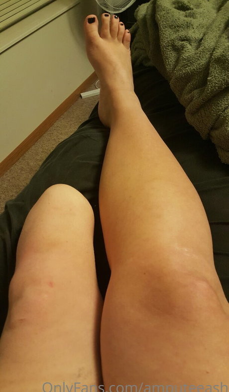 amputeeash star photo