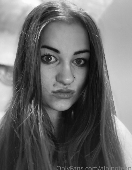 albinoteen exclusive model image