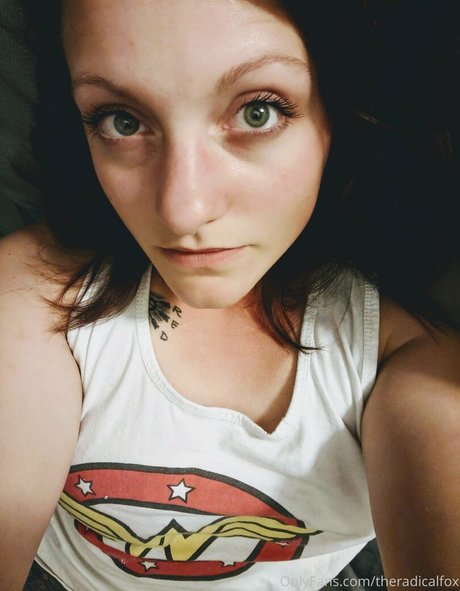 theradicalfox top star photo