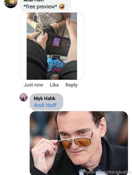 theradicalfox model hd pics