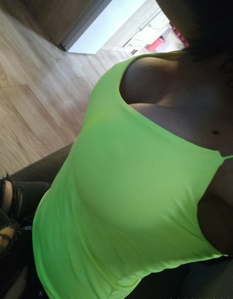 nykolerotic star pornographic images