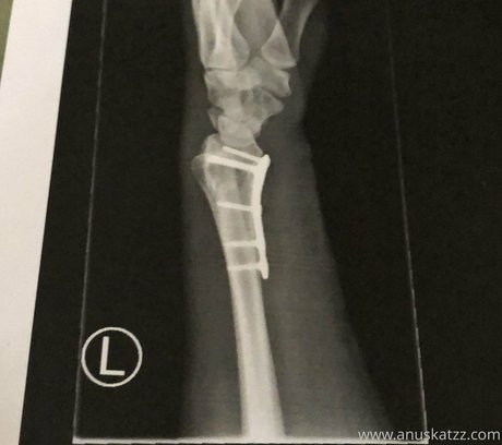 Anuskatzz nice actress picture