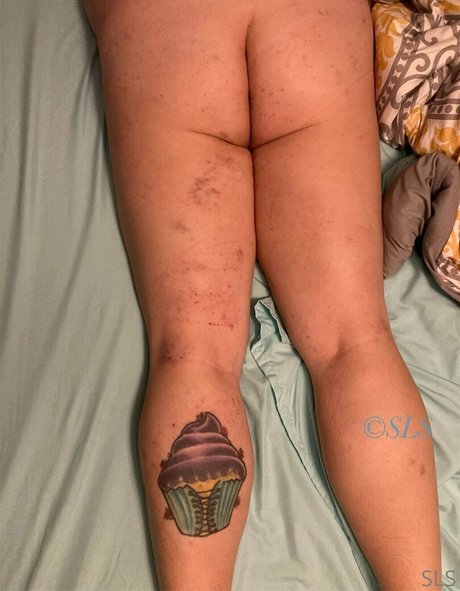 rckyshow pornographic model galleries