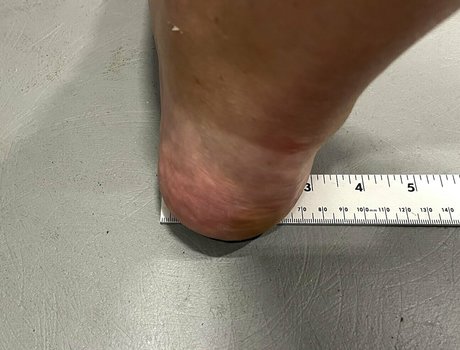 amazonlynn model free archive