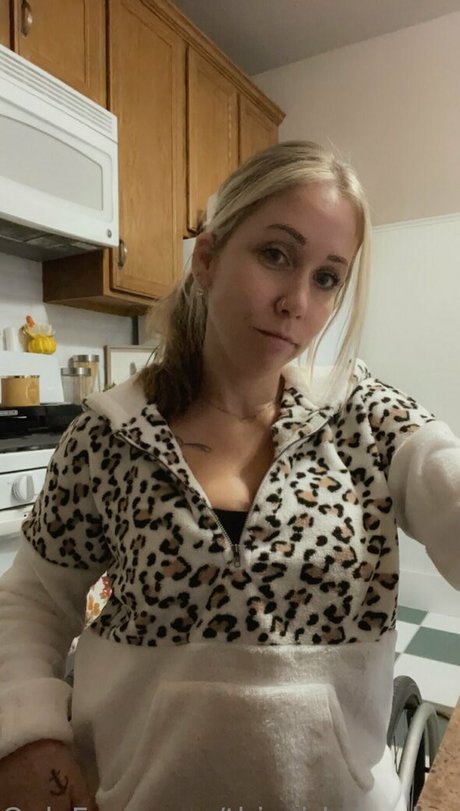 thisgirlwheelsamputee beautiful model photo