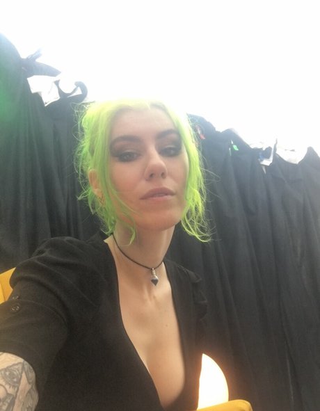 braces onlyfans hd photo