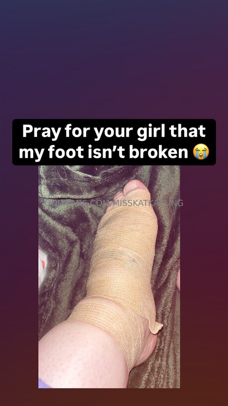 Misskatkalling model nackten bilder