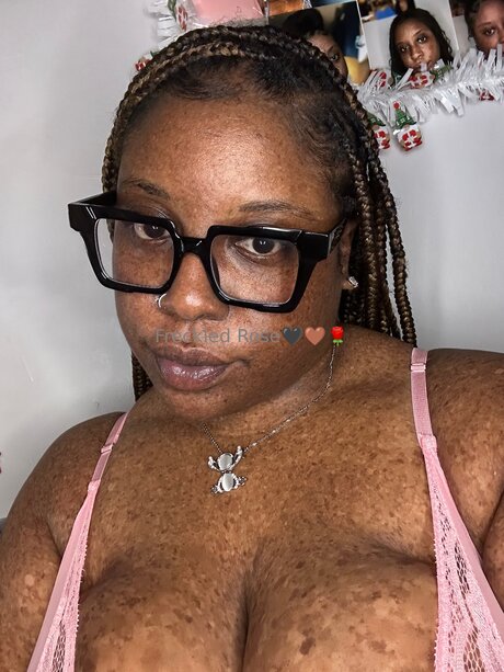 Freckledfantasy5 hübsche nacktheit galerien