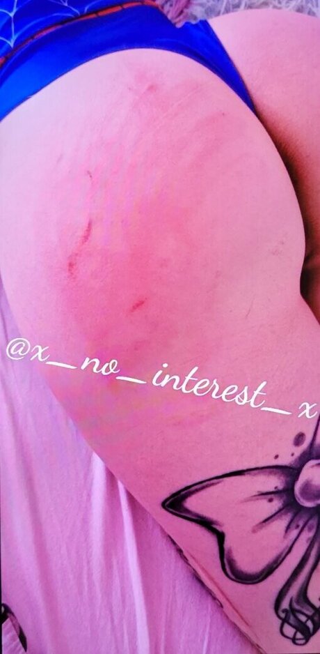 x no interest x nacktheit nette archiv