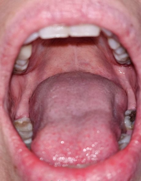 jackdaspeck nackt exklusive foto